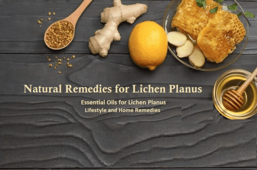 Natural Remedies for Lichen Planus Essential Oils and Herbs to Treats Skin Condition